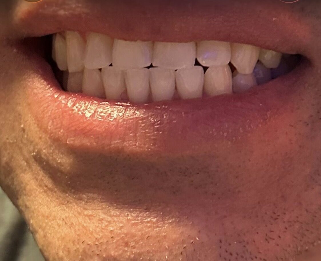 Galería Sonrisa Perfecta 7
