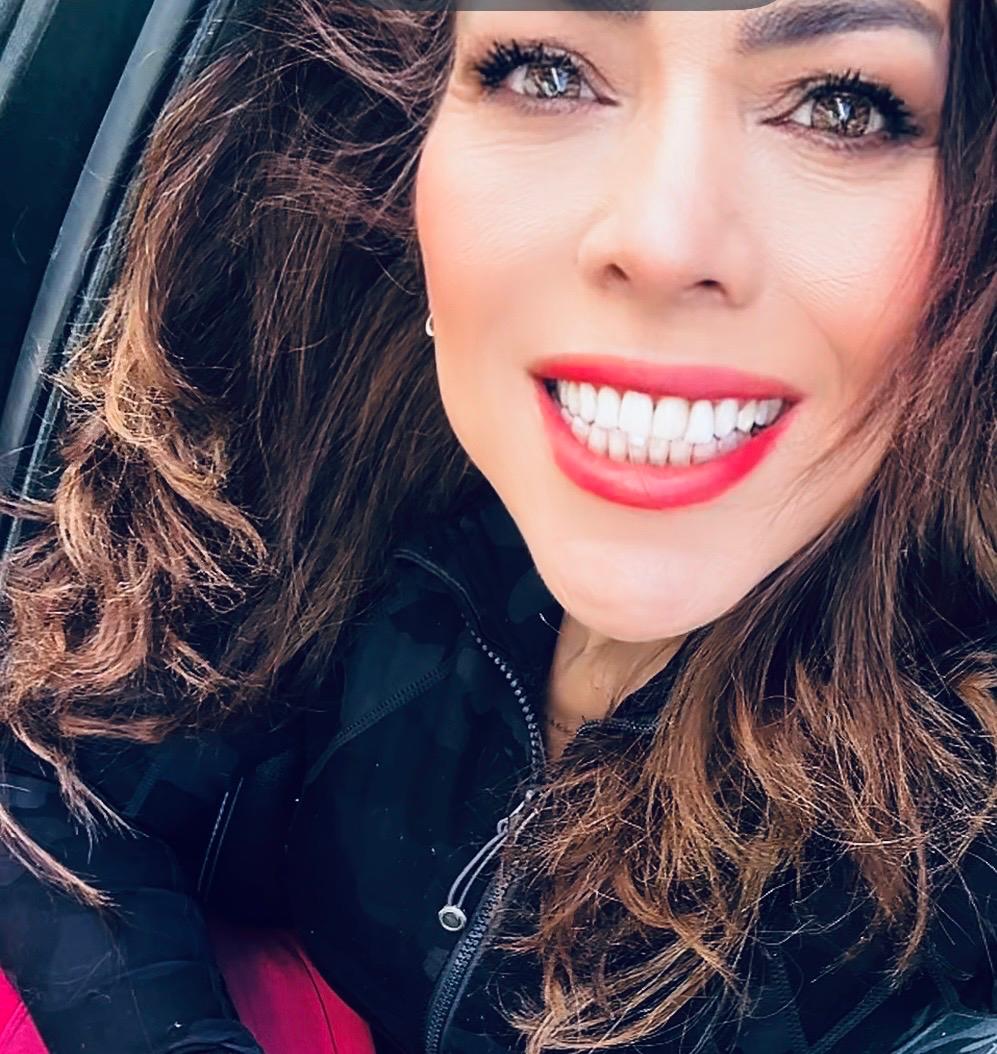 Editorial close-up of a luminous white smile — Sonrisa Perfecta